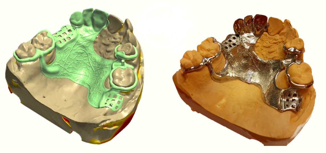 Digital skeletal parts